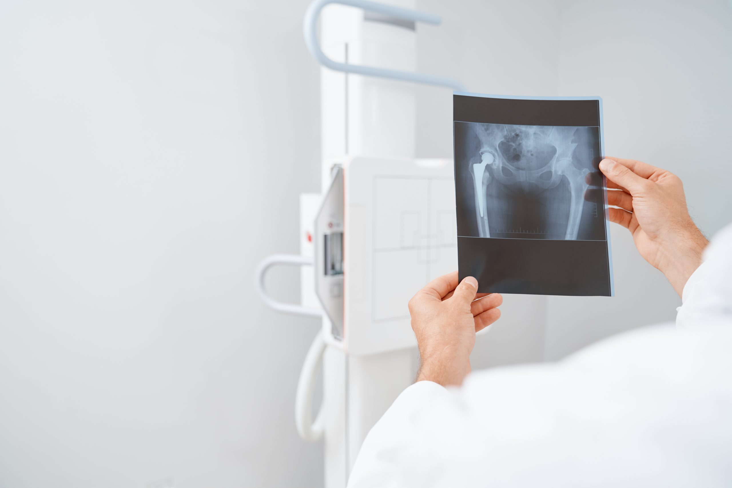Doktor hält ein Hüftenröntgenbild
